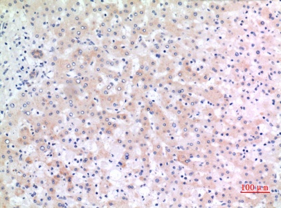 Fig.2. Immunohistochemical analysis of paraffin-embedded human-liver, antibody was diluted at 1:100.