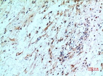 Fig.3. Immunohistochemical analysis of paraffin-embedded human-brain, antibody was diluted at 1:100.