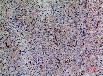 Fig.4. Immunohistochemical analysis of paraffin-embedded human-spleen, antibody was diluted at 1:100.