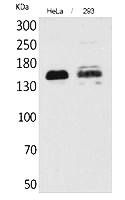 Fig.1. Western Blot analysis of hela, 293 cells using CD148 Polyclonal Antibody. Secondary antibody (catalog#: A21020) was diluted at 1:20000.