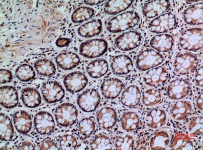Fig.2. Immunohistochemical analysis of paraffin-embedded human-colon, antibody was diluted at 1:100.