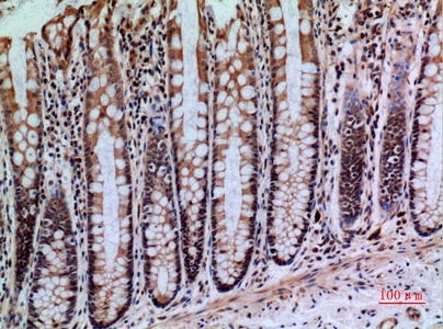 Fig.3. Immunohistochemical analysis of paraffin-embedded human-colon, antibody was diluted at 1:100.