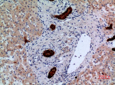 Fig.4. Immunohistochemical analysis of paraffin-embedded human-liver, antibody was diluted at 1:100.