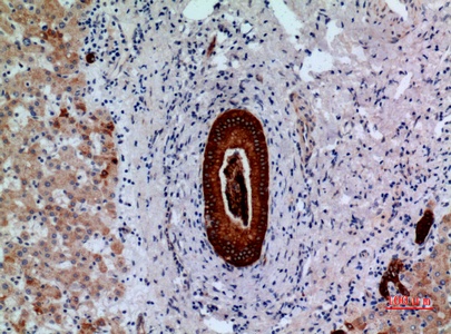 Fig.5. Immunohistochemical analysis of paraffin-embedded human-liver, antibody was diluted at 1:100.