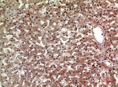 Fig.2. Immunohistochemical analysis of paraffin-embedded human-liver, antibody was diluted at 1:100.
