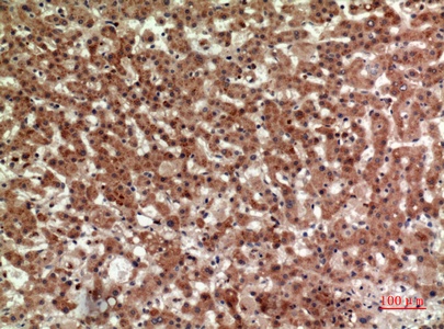 Fig.3. Immunohistochemical analysis of paraffin-embedded human-liver, antibody was diluted at 1:100.