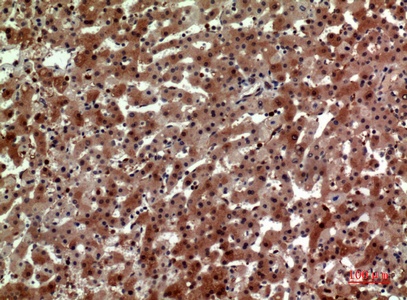 Fig.2. Immunohistochemical analysis of paraffin-embedded human-liver, antibody was diluted at 1:100.