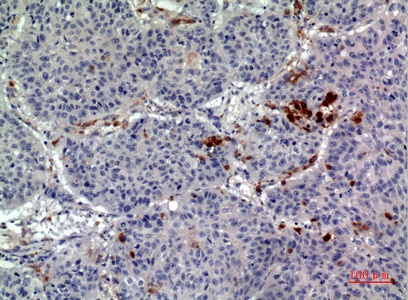 Fig.3. Immunohistochemical analysis of paraffin-embedded human-lung, antibody was diluted at 1:100.