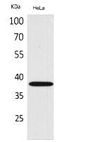 Fig. Western Blot analysis of hela cells using CD158b2/j Polyclonal Antibody. Secondary antibody (catalog#: A21020) was diluted at 1:20000.