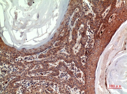 Fig.3. Immunohistochemical analysis of paraffin-embedded human-skin, antibody was diluted at 1:100.