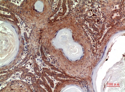 Fig.4. Immunohistochemical analysis of paraffin-embedded human-skin, antibody was diluted at 1:100.