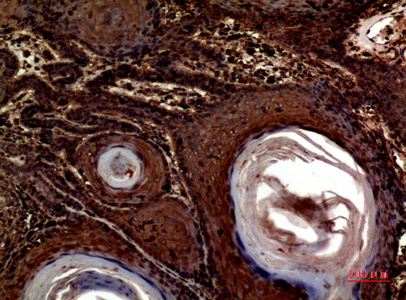 Fig.2. Immunohistochemical analysis of paraffin-embedded human-skin, antibody was diluted at 1:100.