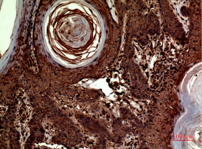 Fig.3. Immunohistochemical analysis of paraffin-embedded human-skin, antibody was diluted at 1:100.