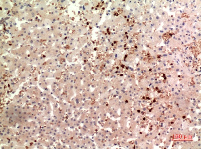 Fig.2. Immunohistochemical analysis of paraffin-embedded human-liver, antibody was diluted at 1:100.