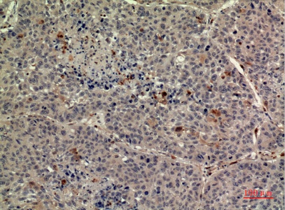 Fig.3. Immunohistochemical analysis of paraffin-embedded human-liver, antibody was diluted at 1:100.