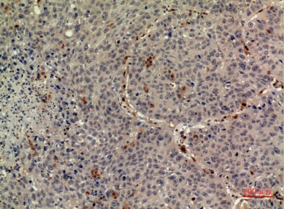 Fig.4. Immunohistochemical analysis of paraffin-embedded human-liver, antibody was diluted at 1:100.