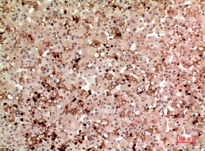 Fig.6. Immunohistochemical analysis of paraffin-embedded human-liver, antibody was diluted at 1:100.