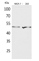 Fig.1. Western Blot analysis of MCF-7, 293 cells using PD-ECGF Polyclonal Antibody. Secondary antibody (catalog#: A21020) was diluted at 1:20000.