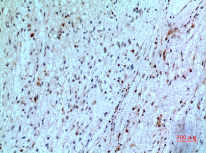 Fig.2. Immunohistochemical analysis of paraffin-embedded human-brain, antibody was diluted at 1:100.