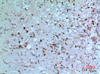 Fig.3. Immunohistochemical analysis of paraffin-embedded human-brain, antibody was diluted at 1:100.