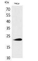 Fig.1. Western Blot analysis of hela cells using IFN-ω Polyclonal Antibody. Secondary antibody (catalog#: A21020) was diluted at 1:20000.