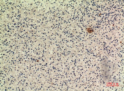 Fig.3. Immunohistochemical analysis of paraffin-embedded human-spleen, antibody was diluted at 1:100.