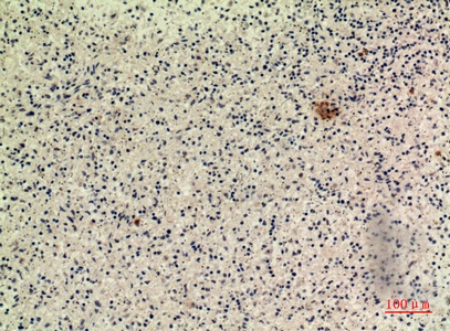 Fig.3. Immunohistochemical analysis of paraffin-embedded human-spleen, antibody was diluted at 1:100.