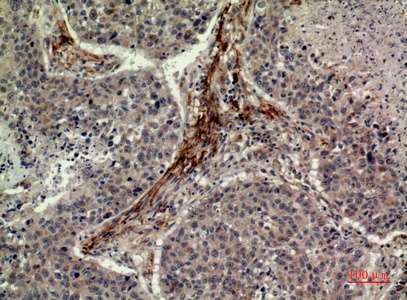 Fig.3. Immunohistochemical analysis of paraffin-embedded human-lung, antibody was diluted at 1:100.