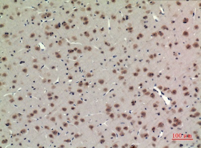 Fig.2. Immunohistochemical analysis of paraffin-embedded rat-brain, antibody was diluted at 1:100.