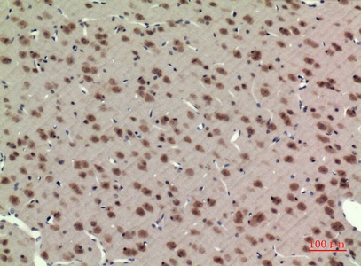 Fig.3. Immunohistochemical analysis of paraffin-embedded rat-brain, antibody was diluted at 1:100.