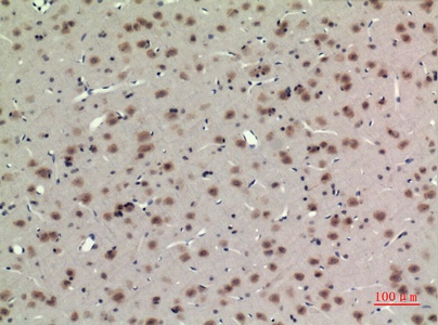 Fig.4. Immunohistochemical analysis of paraffin-embedded rat-brain, antibody was diluted at 1:100.
