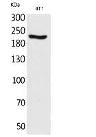 Fig.1. Western Blot analysis of 4T1 cells using MYH-pan Polyclonal Antibody. Secondary antibody (catalog#: A21020) was diluted at 1:20000.