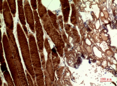 Fig.2. Immunohistochemical analysis of paraffin-embedded human-muscle, antibody was diluted at 1:100.