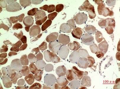 Fig.3. Immunohistochemical analysis of paraffin-embedded human-muscle, antibody was diluted at 1:100.