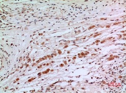Fig.4. Immunohistochemical analysis of paraffin-embedded human-brain, antibody was diluted at 1:100.