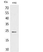 Fig. Western Blot analysis of K562 cells using CyPB Polyclonal Antibody. Secondary antibody (catalog#: A21020) was diluted at 1:20000.