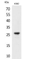 Fig. Western Blot analysis of K562 cells using FGF-8 Polyclonal Antibody. Secondary antibody (catalog#: A21020) was diluted at 1:20000.