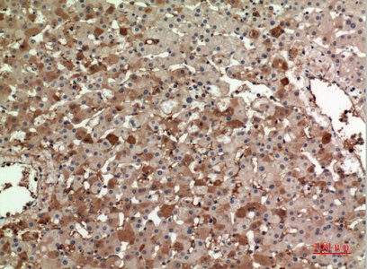 Fig.2. Immunohistochemical analysis of paraffin-embedded human-liver, antibody was diluted at 1:100.