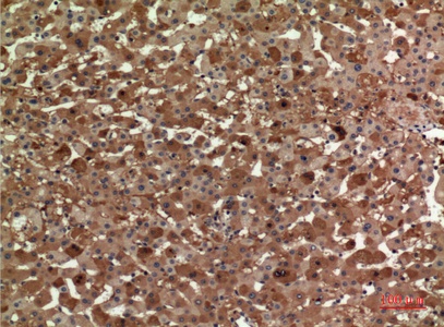 Fig.3. Immunohistochemical analysis of paraffin-embedded human-liver, antibody was diluted at 1:100.
