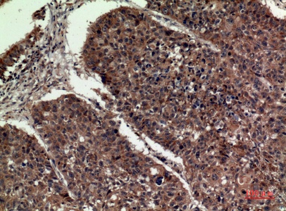 Fig.4. Immunohistochemical analysis of paraffin-embedded human-lung, antibody was diluted at 1:100.