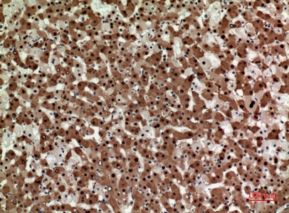 Fig.2. Immunohistochemical analysis of paraffin-embedded human-liver, antibody was diluted at 1:100.