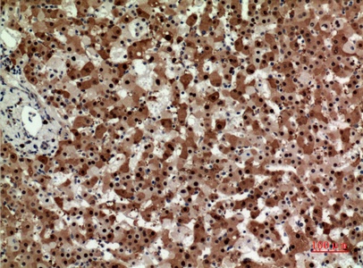 Fig.3. Immunohistochemical analysis of paraffin-embedded human-liver, antibody was diluted at 1:100.