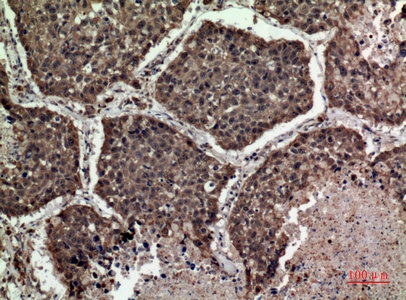 Fig.5. Immunohistochemical analysis of paraffin-embedded human-lung, antibody was diluted at 1:100.