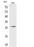 Fig.1. Western Blot analysis of K562 cells using FGF-16 Polyclonal Antibody. Secondary antibody (catalog#: A21020) was diluted at 1:20000.