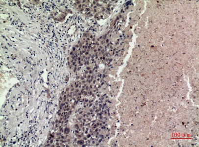 Fig.2. Immunohistochemical analysis of paraffin-embedded human-lung, antibody was diluted at 1:100.