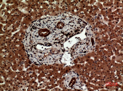 Fig.2. Immunohistochemical analysis of paraffin-embedded human-liver, antibody was diluted at 1:100.