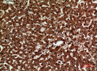 Fig.3. Immunohistochemical analysis of paraffin-embedded human-liver, antibody was diluted at 1:100.