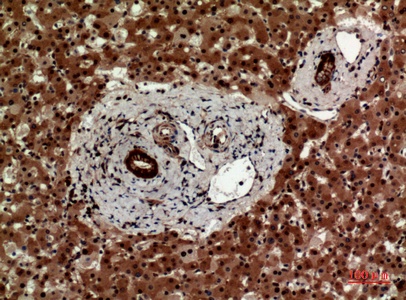 Fig.4. Immunohistochemical analysis of paraffin-embedded human-liver, antibody was diluted at 1:100.