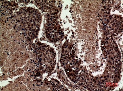 Fig.5. Immunohistochemical analysis of paraffin-embedded human-lung, antibody was diluted at 1:100.