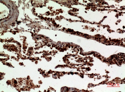 Fig.6. Immunohistochemical analysis of paraffin-embedded human-lung, antibody was diluted at 1:100.